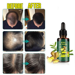7-Day Herb Germinal Serum. Shop Hair Loss Treatments on Mounteen. Worldwide shipping available.