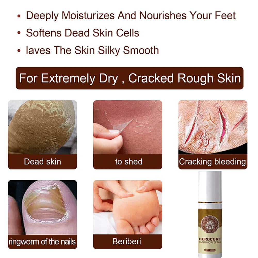 Anti-Fungal Treatment Spray. Shop Nail Care on Mounteen. Worldwide shipping available.