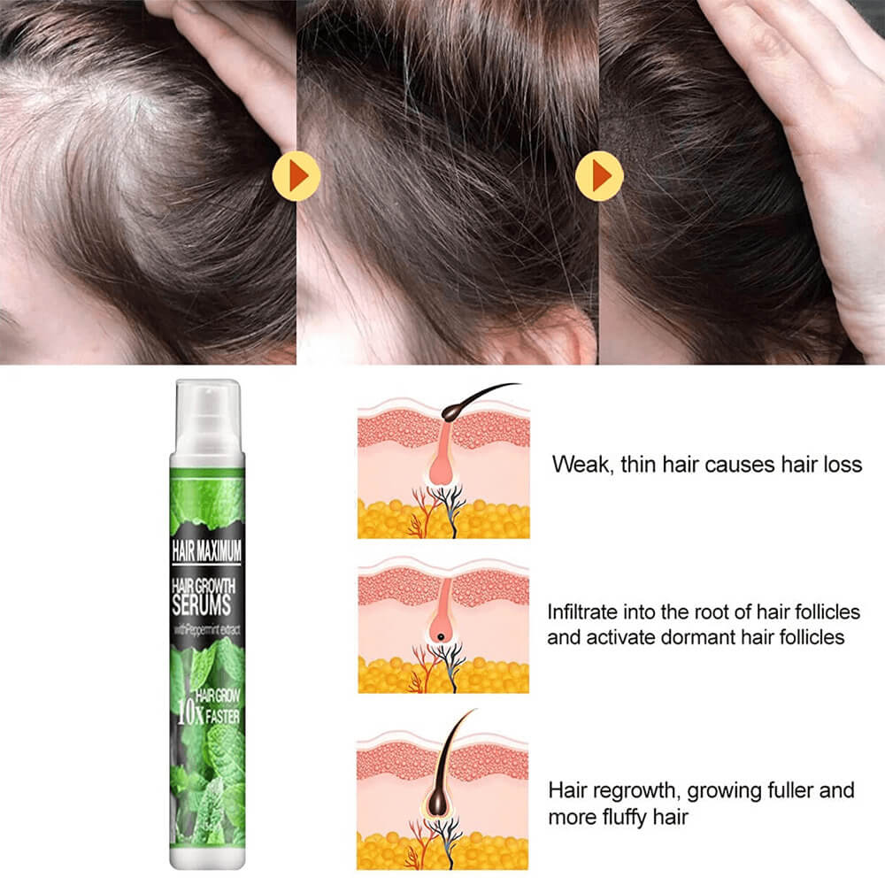Hair Re-Birth Herbal Spray. Shop Hair Loss Treatments on Mounteen. Worldwide shipping available.