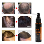 Hair Re-Growth Herbal Essence Spray. Shop Hair Loss Treatments on Mounteen. Worldwide shipping available.