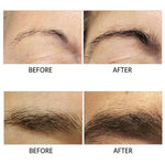 Eyebrows Growth Serum - Mounteen. Worldwide shipping available.