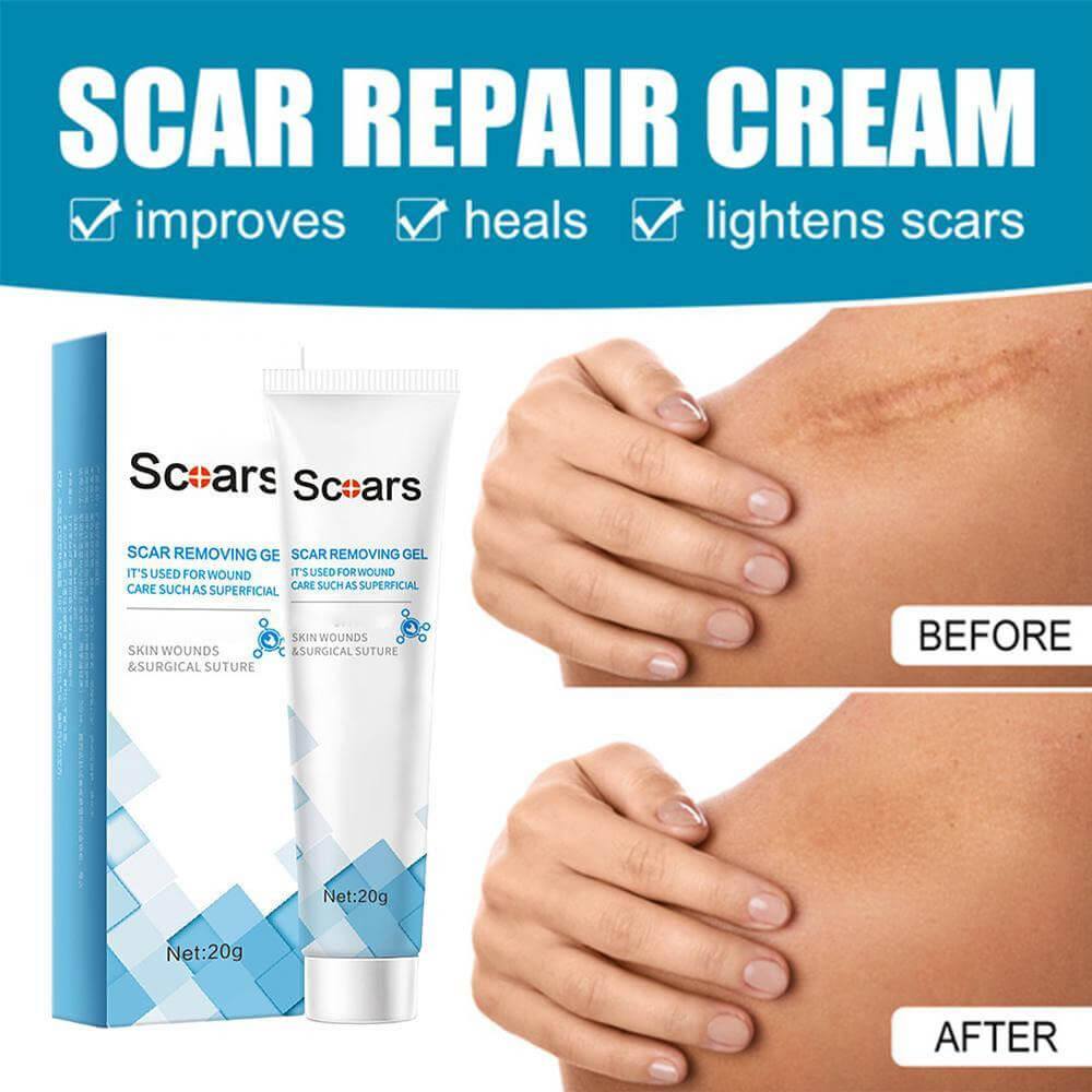 OrgPure Organic Scar Removing Gel. Shop Skin Care on Mounteen. Worldwide shipping available.