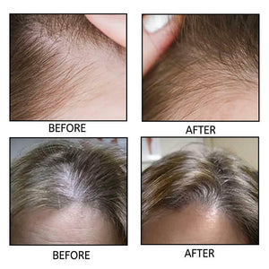 Origin GROWTH Anti-Hair Loss Rice Shampoo Bar. Shop Shampoo on Mounteen. Worldwide shipping available.