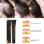 Regrowth Organic Hair Serum Roller. Shop Hair Loss Treatments on Mounteen. Worldwide shipping available.