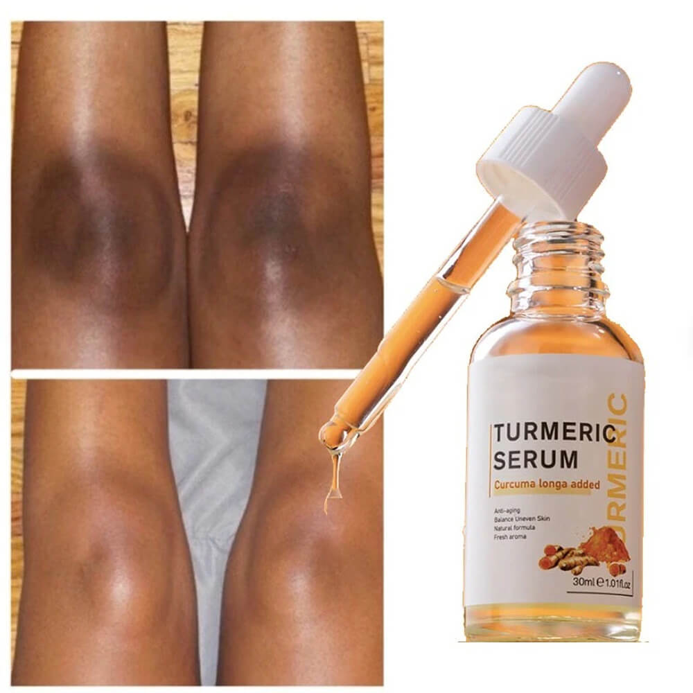 Turmeric Dark Spot Corrector Serum. Shop Skin Care on Mounteen. Worldwide shipping available.