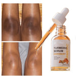 Turmeric Dark Spot Remover Serum. Shop Skin Care on Mounteen. Worldwide shipping available.