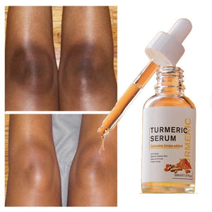 Turmeric Face Serum. Shop Acne Treatments & Kits on Mounteen. Worldwide shipping available.
