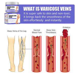 Vein Care Fading Cream. Shop Skin Care on Mounteen. Worldwide shipping available.