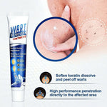 WartsOff Instant Blemish Removal Cream. Shop Wart Removers on Mounteen. Worldwide shipping available.